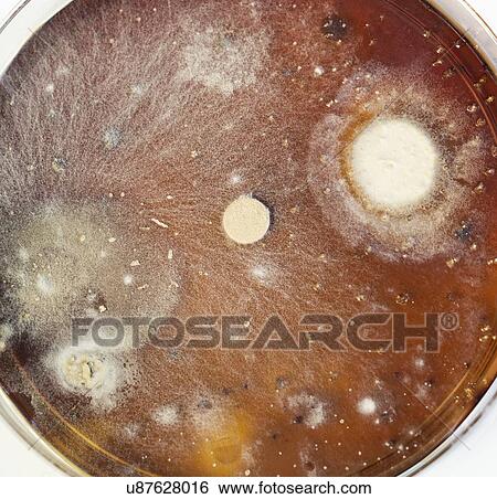 Stock Photograph - Microbes growing on agar plate.. Fotosearch