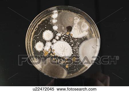 Stock Photography - Microbes growing on agar plate.. Fotosearch