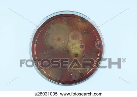 Stock Photography - Microbes growing on agar plate.. Fotosearch