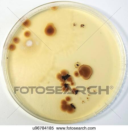 Stock Photography - Microbes growing on agar plate.. Fotosearch