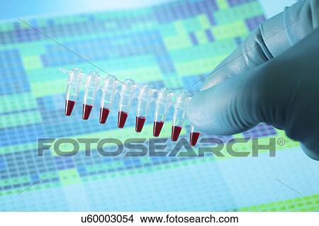 Picture - Microcentrifuge tubes with samples.. Fotosearch