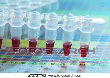 Stock Image - Microcentrifuge tubes with samples.. Fotosearch