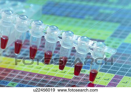 Stock Photo - Microcentrifuge tubes with samples.. Fotosearch