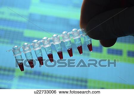 Stock Photograph - Microcentrifuge tubes with samples.. Fotosearch