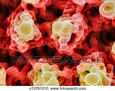Microstructures on nickel. Coloured scanning electron micrograph (SEM) of microstructures formed on a nickel surface by a laser beam. This research involves the use of lasers to etch and ablate metal and semiconductor surfaces. The resulting... View Large Photo Image Stock Image - Microstructures on nickel. Coloured scanning electron micrograph (SEM) of microstructures formed on a nickel surface by a laser beam. This research involves the use of lasers to etch and ablate metal and semiconductor surfaces. The resulting.... Fotosearch