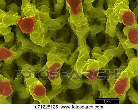 Microstructures on nickel. Coloured scanning electron micrograph (SEM) of microstructures formed on a nickel surface by a laser beam. This research involves the use of lasers to etch and ablate metal and semiconductor surfaces. The resulting... View Large Photo Image Stock Photography - Microstructures on nickel. Coloured scanning electron micrograph (SEM) of microstructures formed on a nickel surface by a laser beam. This research involves the use of lasers to etch and ablate metal and semiconductor surfaces. The resulting.... Fotosearch