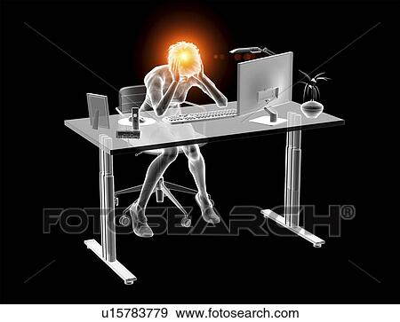Migraine, conceptual computer illustration. View Large Photo Image Stock Photo - Migraine, conceptual computer illustration.. Fotosearch