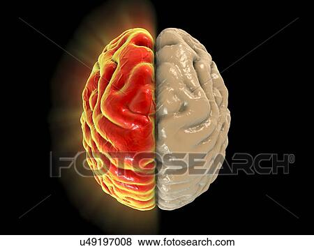 Migraine, conceptual computer illustration. View Large Photo Image Stock Photo - Migraine, conceptual computer illustration.. Fotosearch