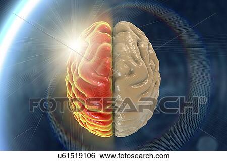 Migraine, conceptual computer illustration. View Large Photo Image Stock Photograph - Migraine, conceptual computer illustration.. Fotosearch