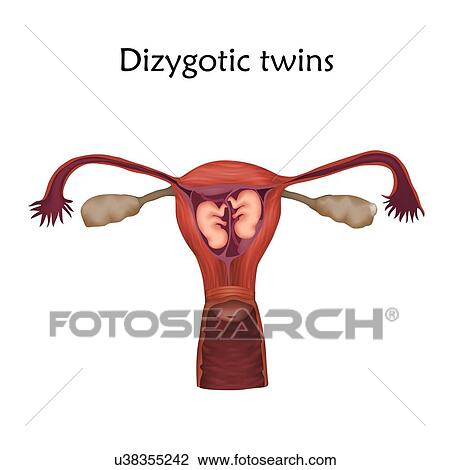 Stock Image - Multiple pregnancy. Dizygotic twins developing in the uterus separately.. Fotosearch