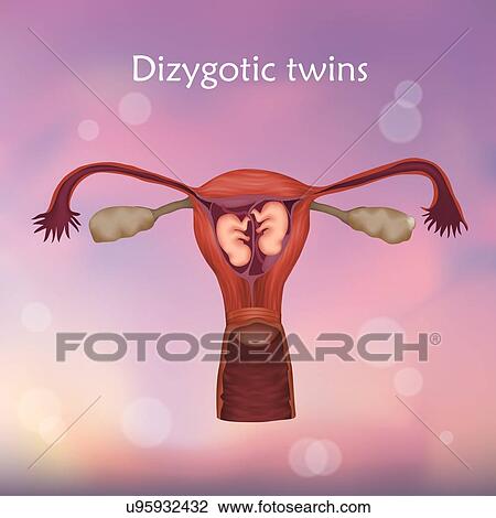Multiple pregnancy. Dizygotic twins developing in the uterus separately. View Large Photo Image Stock Image - Multiple pregnancy. Dizygotic twins developing in the uterus separately.. Fotosearch
