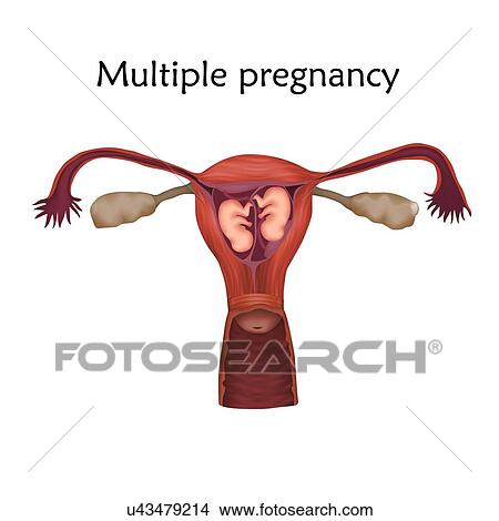 Picture - Multiple pregnancy, illustration. Two embryos in a uterus.. Fotosearch