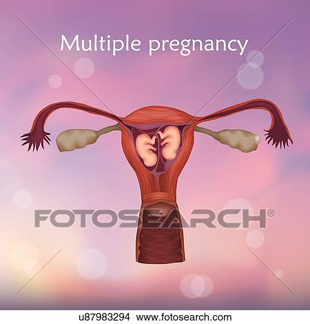 Picture - Multiple pregnancy, illustration. Two embryos in the uterus.. Fotosearch