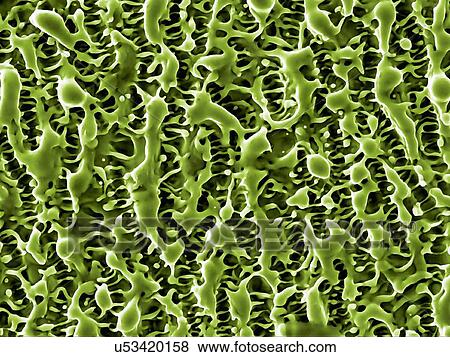 Nanostructures on nickel. Coloured scanning electron micrograph (SEM) of nanostructures formed on a nickel surface by a laser beam. This research involves the use of lasers to etch and ablate metal and semiconductor surfaces. The resulting... View Large Photo Image Stock Photo - Nanostructures on nickel. Coloured scanning electron micrograph (SEM) of nanostructures formed on a nickel surface by a laser beam. This research involves the use of lasers to etch and ablate metal and semiconductor surfaces. The resulting.... Fotosearch