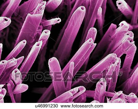 Nanostructures on vanadium. Coloured scanning electron micrograph (SEM) of nanostructures formed on a vanadium and vanadium oxide surface by a carbon dioxide laser beam. This research involves the use of lasers to etch and ablate metal and... View Large Photo Image Stock Image - Nanostructures on vanadium. Coloured scanning electron micrograph (SEM) of nanostructures formed on a vanadium and vanadium oxide surface by a carbon dioxide laser beam. This research involves the use of lasers to etch and ablate metal and.... Fotosearch