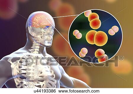 Neisseria meningitidis brain infection, computer illustration. N. meningitidis are gram-negative diplococci (spherical bacteria arranged in pairs), transmitted via the respiratory route. In most people they cause either asymptomatic infections or... View Large Photo Image Stock Photograph - Neisseria meningitidis brain infection, computer illustration. N. meningitidis are gram-negative diplococci (spherical bacteria arranged in pairs), transmitted via the respiratory route. In most people they cause either asymptomatic infections or.... Fotosearch