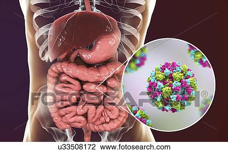 Stock Image - Norovirus infection, computer illustration. Norovirus is a genus of RNA (ribonucleic acid) viruses (of the family Caliciviridae), which cause about half of all gastroenteritis cases around the world. The disease is characterised by nausea, vomiting,.... Fotosearch