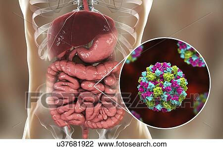 Stock Image - Norovirus infection, computer illustration. Norovirus is a genus of RNA (ribonucleic acid) viruses (of the family Caliciviridae), which cause about half of all gastroenteritis cases around the world. The disease is characterised by nausea, vomiting,.... Fotosearch