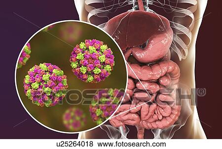 Norovirus infection, computer illustration. Norovirus is a genus of RNA (ribonucleic acid) viruses (of the family Caliciviridae), which cause about half of all gastroenteritis cases around the world. The disease is characterised by nausea, vomiting,... View Large Photo Image Stock Photo - Norovirus infection, computer illustration. Norovirus is a genus of RNA (ribonucleic acid) viruses (of the family Caliciviridae), which cause about half of all gastroenteritis cases around the world. The disease is characterised by nausea, vomiting,.... Fotosearch