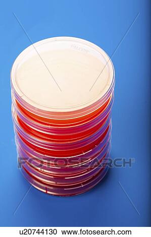 Stock Image - Petri dishes with blood agar.. Fotosearch