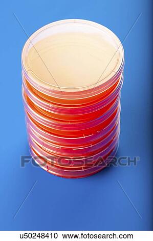 Stock Image - Petri dishes with blood agar.. Fotosearch