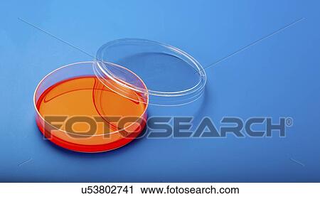 Stock Image - Petri dishes with blood agar.. Fotosearch