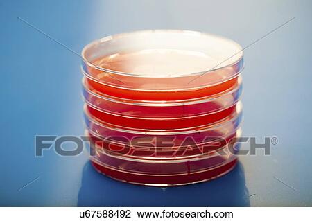 Petri dishes with blood agar. View Large Photo Image Stock Image - Petri dishes with blood agar.. Fotosearch
