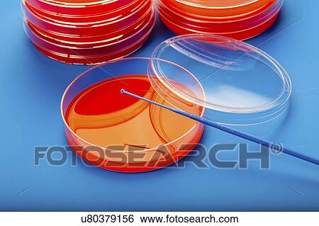 Stock Photograph - Petri dishes with blood agar.. Fotosearch