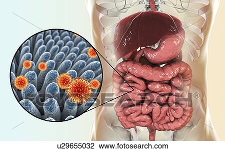 Stock Image - Rotaviruses infecting intestine, computer illustration. The virus particle consists of an RNA (ribonucleic acid) core surrounded by a triple layered capsid. Rotaviruses are probably the most common viruses to infect humans and animals. They are.... Fotosearch