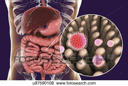 Rotaviruses infecting intestine, computer illustration. The virus particle consists of an RNA (ribonucleic acid) core surrounded by a triple layered capsid. Rotaviruses are probably the most common viruses to infect humans and animals. They are... View Large Photo Image Stock Photo - Rotaviruses infecting intestine, computer illustration. The virus particle consists of an RNA (ribonucleic acid) core surrounded by a triple layered capsid. Rotaviruses are probably the most common viruses to infect humans and animals. They are.... Fotosearch