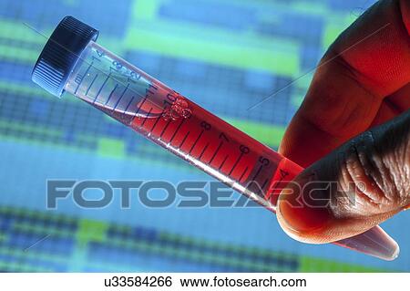 Sample for genetic analysis. View Large Photo Image Stock Photograph - Sample for genetic analysis.. Fotosearch