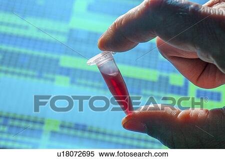 Sample for genetic analysis. View Large Photo Image Stock Photography - Sample for genetic analysis.. Fotosearch