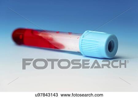Sample in phial. View Large Photo Image Stock Image - Sample in phial.. Fotosearch