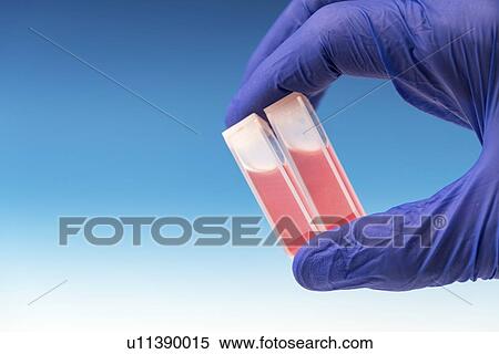 Stock Photography - Samples in cuvettes.. Fotosearch
