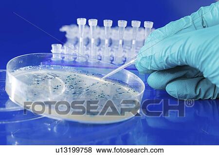 Sampling colony from Petri dish. View Large Photo Image Stock Photo - Sampling colony from Petri dish.. Fotosearch