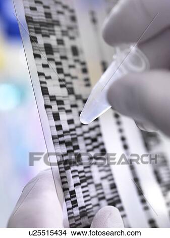 Picture - Scientist holding a DNA (deoxyribonucleic acid) sample in a tube with the results illustrated on a DNA gel.. Fotosearch