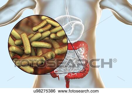 Stock Photograph - Shigellosis, an infection caused by Shigella bacteria, computer illustration. Shigella sp. are Gram-negative rod-shaped bacteria (bacilli). They infect the large intestine and cause dysentery, which can vary in severity from a mild attack of diarrhoea.... Fotosearch