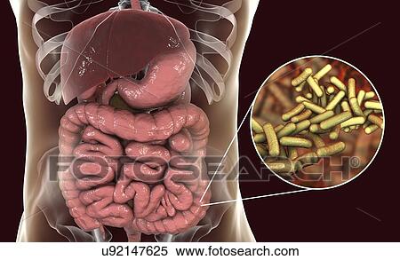 Stock Photography - Shigellosis, an infection caused by Shigella bacteria, computer illustration. Shigella sp. are Gram-negative rod-shaped bacteria (bacilli). They infect the large intestine and cause dysentery, which can vary in severity from a mild attack of diarrhoea.... Fotosearch