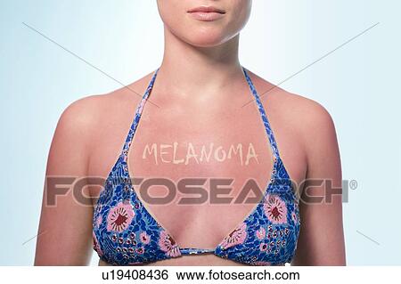 Skin cancer from sun damage, conceptual image. Woman with 'melanoma' written on her sunburnt chest. View Large Photo Image Stock Photograph - Skin cancer from sun damage, conceptual image. Woman with 'melanoma' written on her sunburnt chest.. Fotosearch