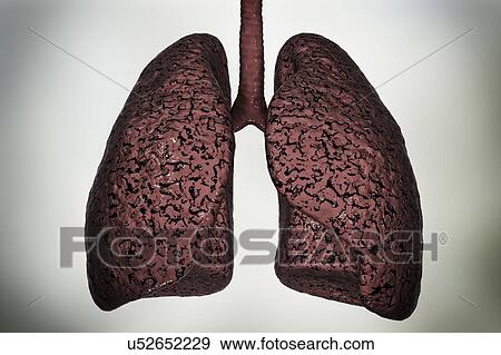 Smoker's lungs, computer illustration. View Large Photo Image Stock Photo - Smoker's lungs, computer illustration.. Fotosearch