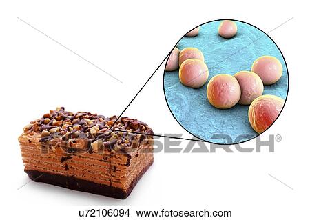 Picture - Staphylococcal food poisoning, conceptual illustration. S. aureus is the causative agent of different diseases, one of them is food poisoning that occurs after ingestion of food contaminated with staphylococcal enterotoxin.. Fotosearch