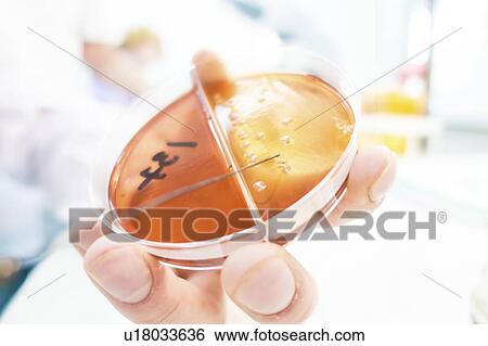 Stock Photograph - Streaking culture onto agar plate.. Fotosearch