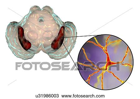 Substantia nigra. Computer illustration showing a healthy substantia nigra from a human brain and a close-up view of dopaminergic neurons found in the substantia nigra. The substantia nigra plays an important role in reward, addiction, and movement.... View Large Photo Image Stock Image - Substantia nigra. Computer illustration showing a healthy substantia nigra from a human brain and a close-up view of dopaminergic neurons found in the substantia nigra. The substantia nigra plays an important role in reward, addiction, and movement..... Fotosearch