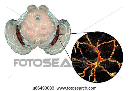 Substantia nigra. Computer illustration showing a degenerated substantia nigra in Parkinson's disease. The substantia nigra plays an important role in reward, addiction, and movement. Degeneration of this structure is characteristic of Parkinson's... View Large Photo Image Stock Image - Substantia nigra. Computer illustration showing a degenerated substantia nigra in Parkinson's disease. The substantia nigra plays an important role in reward, addiction, and movement. Degeneration of this structure is characteristic of Parkinson's.... Fotosearch