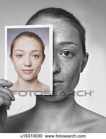 Stock Image - Sun damage. Woman showing the damage sun exposure has done to her skin.. Fotosearch