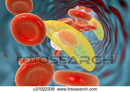Stock Photo - Toxoplasma gondii in blood, illustration. T. gondii is a species of parasitic protozoa that can be carried by all known mammals. It causes toxoplasmosis, a usually minor and self-limiting disease. It can, however, have serious or even fatal effects on.... Fotosearch
