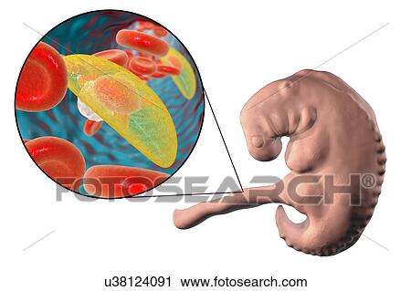 Stock Image - Transplacental transmission of Toxoplasma gondii parasites to human embryo, conceptual illustration. T. gondii is a species of parasitic protozoa that can be carried by all known mammals. It causes toxoplasmosis, a usually minor and self-limiting.... Fotosearch