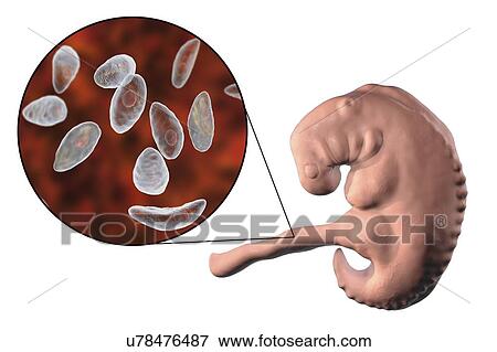 Transplacental transmission of Toxoplasma gondii parasites to human embryo, conceptual illustration. T. gondii is a species of parasitic protozoa that can be carried by all known mammals. It causes toxoplasmosis, a usually minor and self-limiting... View Large Photo Image Stock Photo - Transplacental transmission of Toxoplasma gondii parasites to human embryo, conceptual illustration. T. gondii is a species of parasitic protozoa that can be carried by all known mammals. It causes toxoplasmosis, a usually minor and self-limiting.... Fotosearch