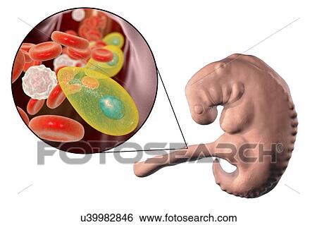 Transplacental transmission of Toxoplasma gondii parasites to human embryo, conceptual illustration. T. gondii is a species of parasitic protozoa that can be carried by all known mammals. It causes toxoplasmosis, a usually minor and self-limiting... View Large Photo Image Stock Photograph - Transplacental transmission of Toxoplasma gondii parasites to human embryo, conceptual illustration. T. gondii is a species of parasitic protozoa that can be carried by all known mammals. It causes toxoplasmosis, a usually minor and self-limiting.... Fotosearch