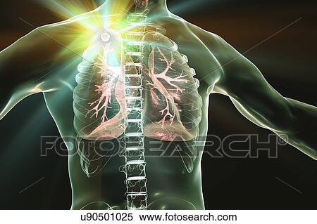 Treatment and prevention of tuberculosis, conceptual illustration. View Large Photo Image Stock Photography - Treatment and prevention of tuberculosis, conceptual illustration.. Fotosearch